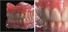 custom smile design