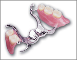cast metal partial