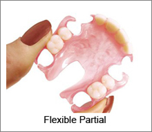 flexible partial denture